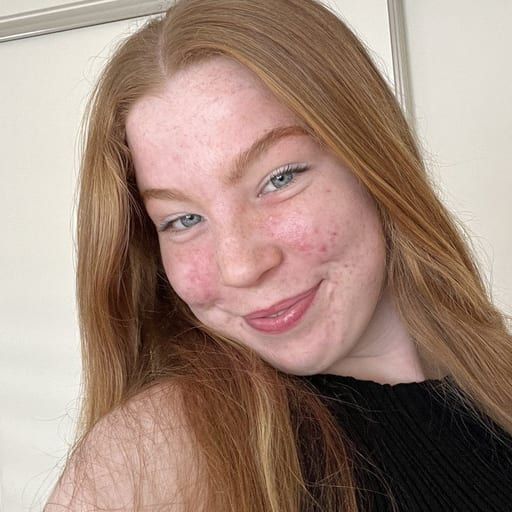Lizzie Mcinnes